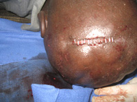 Pic - MOSA - Haiti Earthquake Relief Project - 2010